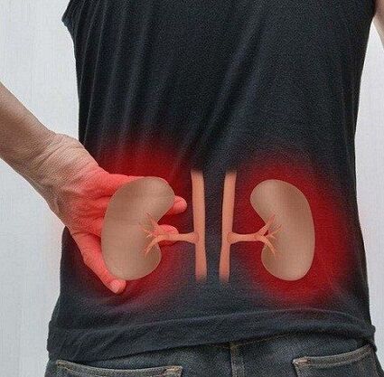 Niddereg Schmerz kann mat Pyelonephritis geschéien