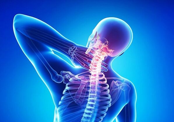 Péng an der Gebärmutterkierper mat Osteochondrosis