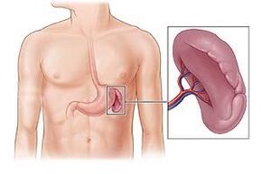 Pathologie vun der Mëlz als Ursaach vu Schmerz ënner der lénkser Schëllerblade