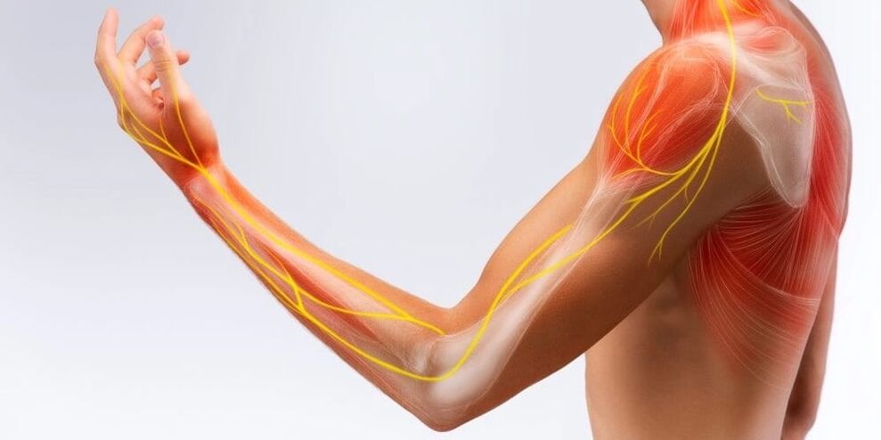 Péng an Numbness vun de Fanger weisen Schued un de Bande wéinst stenosing Ligamentitis