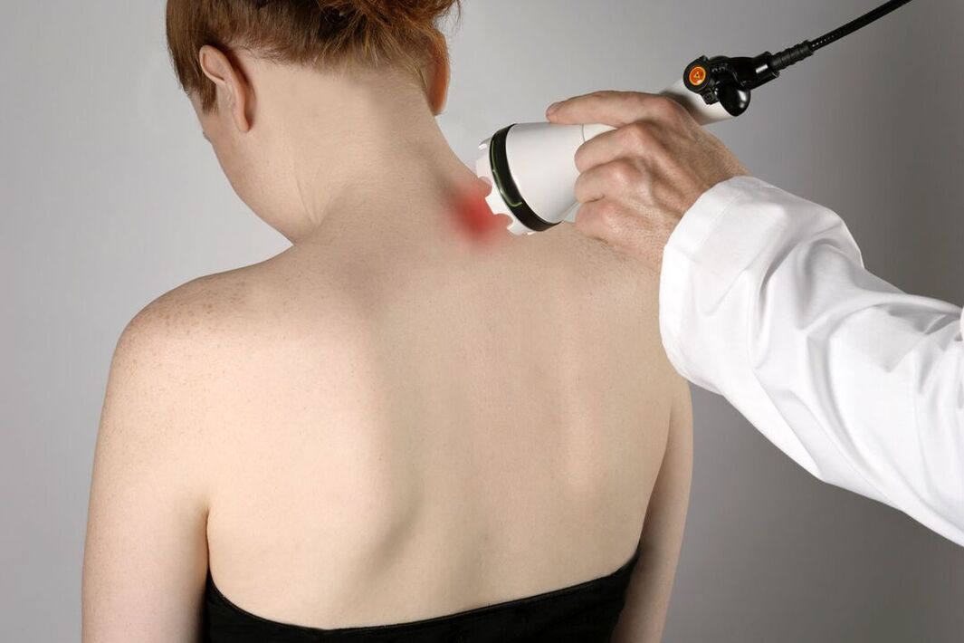 physiotherapeutesch Behandlung vun cervical osteochondrosis